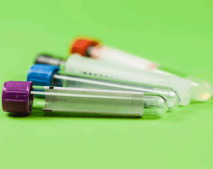 Lab Tests in the Comfort of Your Own Home Made Easy