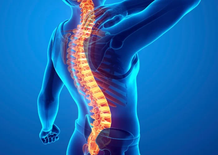 Back Pain Image 02