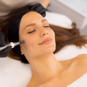 Mobile Micro-Needling