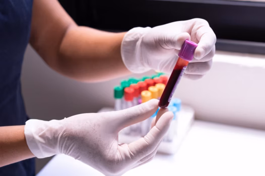 Mobile Phlebotomy & Lab Services
