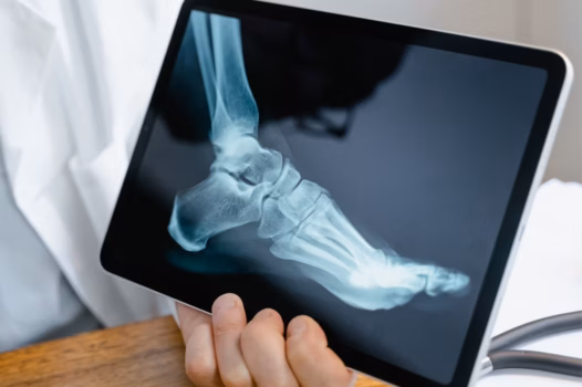 Mobile X-Rays