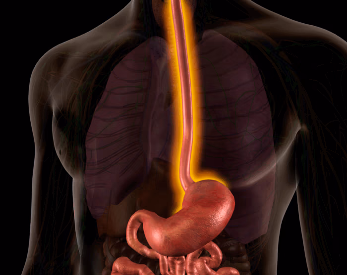 Esophageal Cancer Is on the Rise: Here’s What You Can Do About It