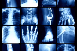 Mobile Imaging Fast-Tracking Diagnosis & Treatment Plans