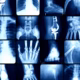 Mobile Imaging: Facilitating A Timely Diagnosis And Treatment Planning