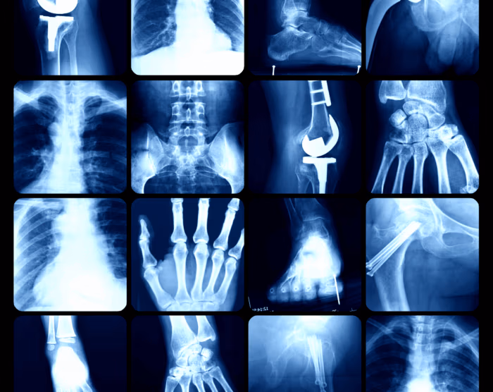 Mobile Imaging Fast-Tracking Diagnosis & Treatment Plans
