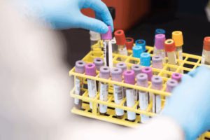 Reliable In-Home Lab Testing That Puts You First; Always