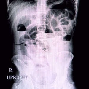 Abdominal X-Rays