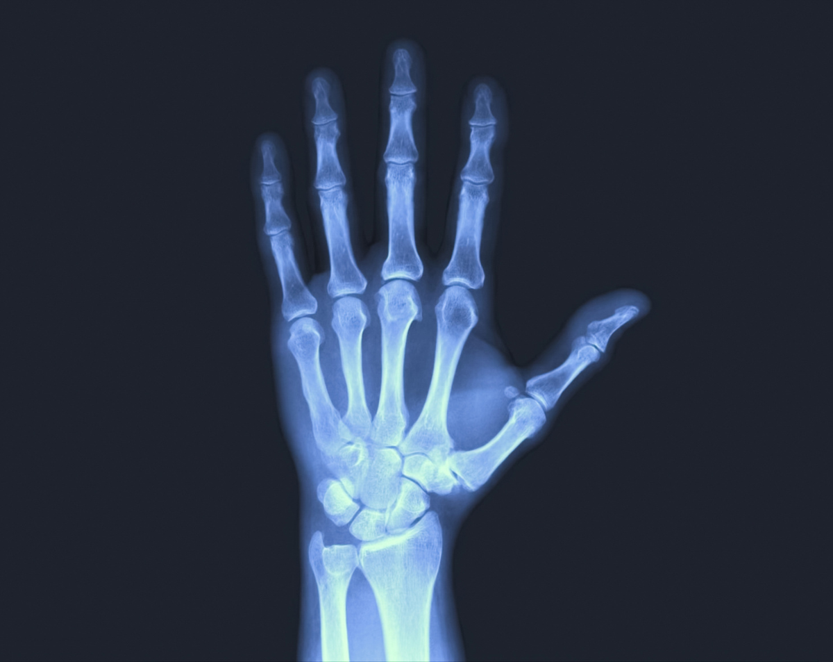 Hand X-Ray