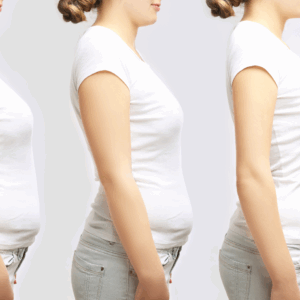 Medical Weight Loss Consultation