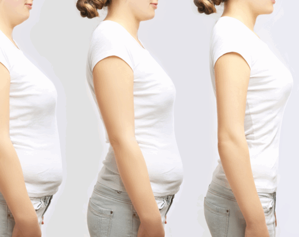 Medical Weight Loss Consultation