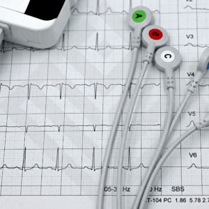 Electrocardiogram (EKG/ECG) Test