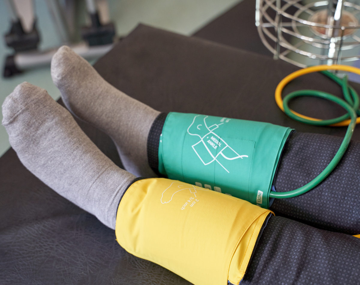 Ankle Brachial Index Ultrasound