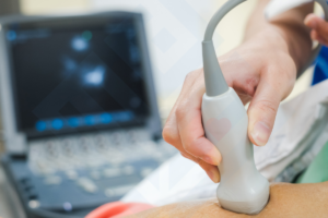 Echocardiogram At Home