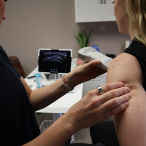 UE Arterial Ultrasound